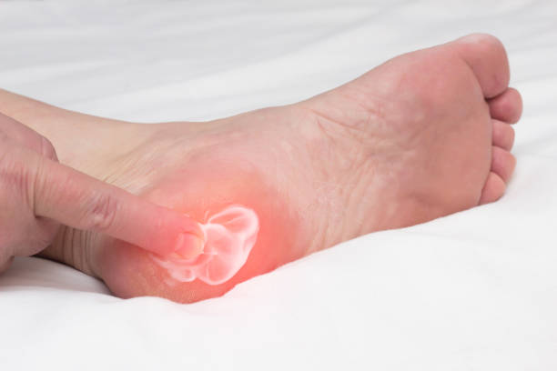Plantar Fasciitis Shoes