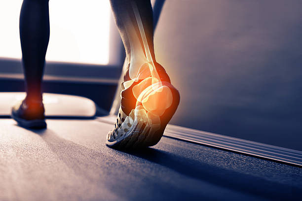 Arthritis in Foot