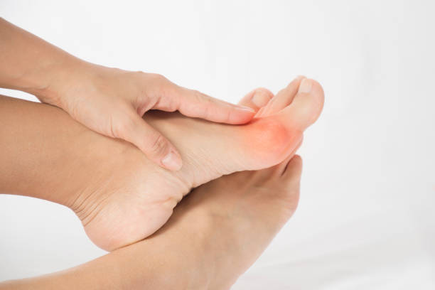 What is a Bunion? Expert Guide to the Best Shoes for Bunions